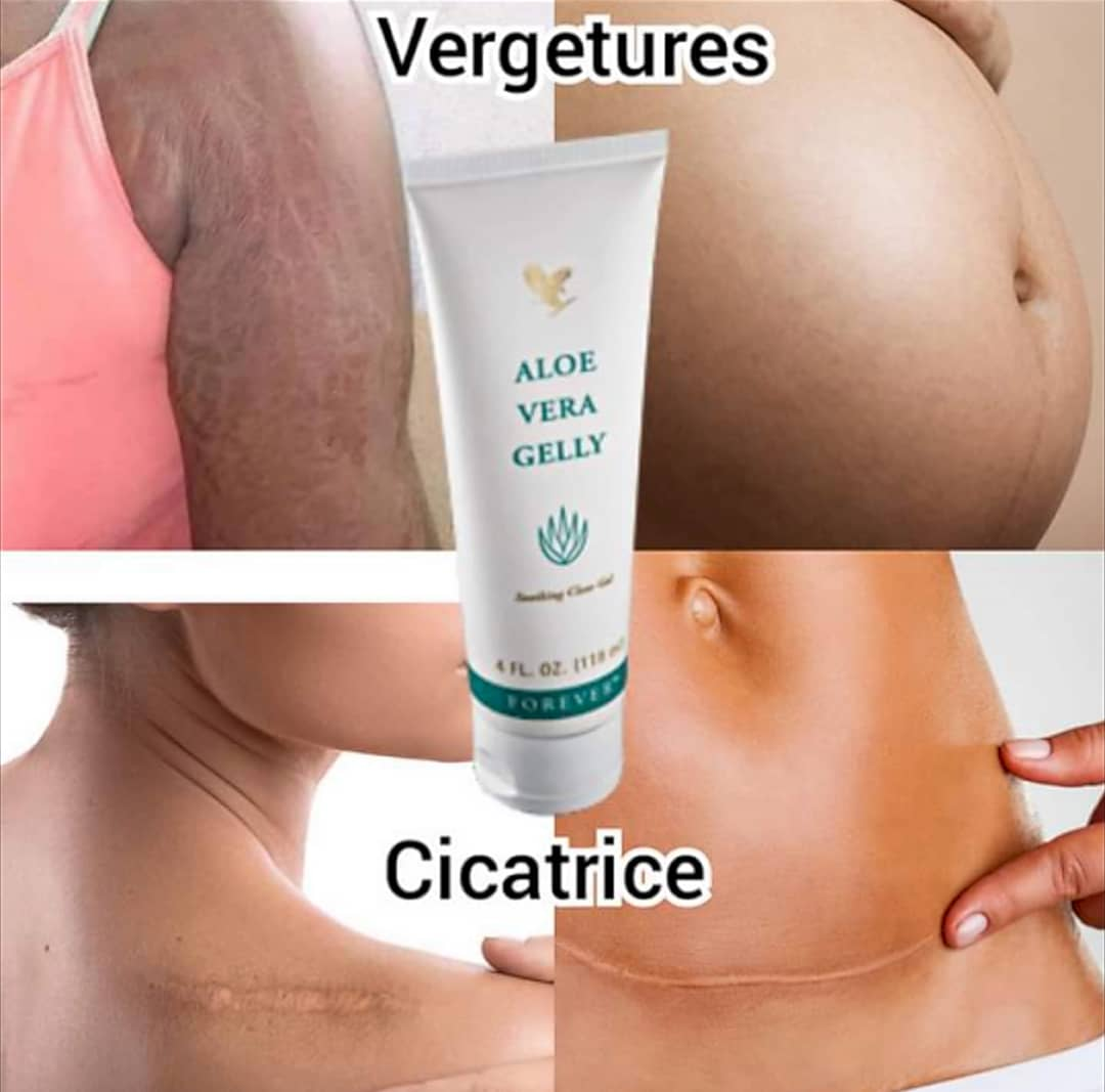 Forever Aloe Gelly